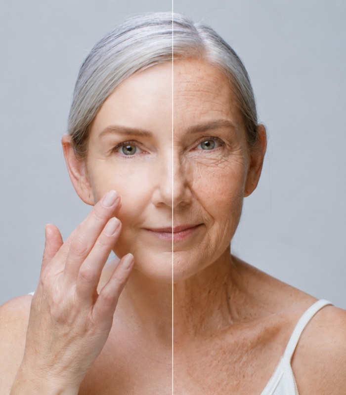 about-image